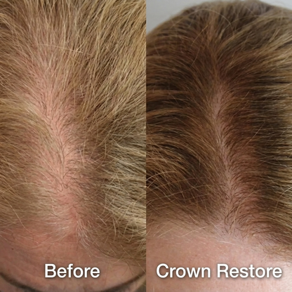 Luma Labs Crown Restore - Buy 2 Get 4 FREE