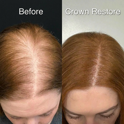 Luma Labs Crown Restore - Buy 2 Get 4 FREE