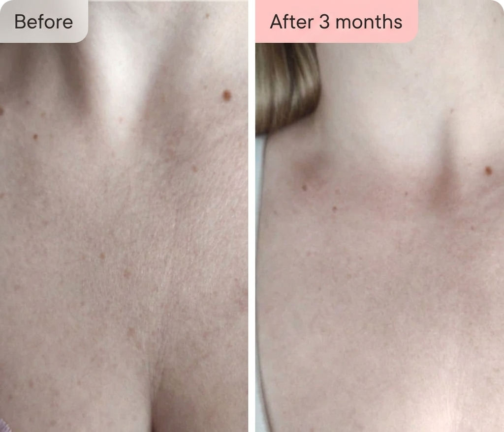 Luma Labs - Neck + Décolletage Restore