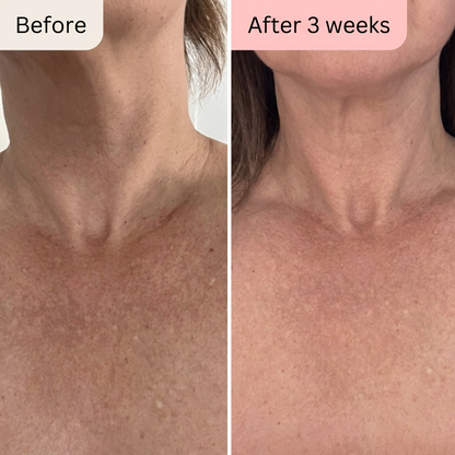 Luma Labs - Neck + Décolletage Restore