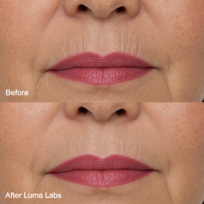 Luma Labs Lip Line Restore