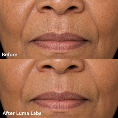 Luma Labs Lip Line Restore