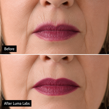 Luma Labs Lip Line Restore