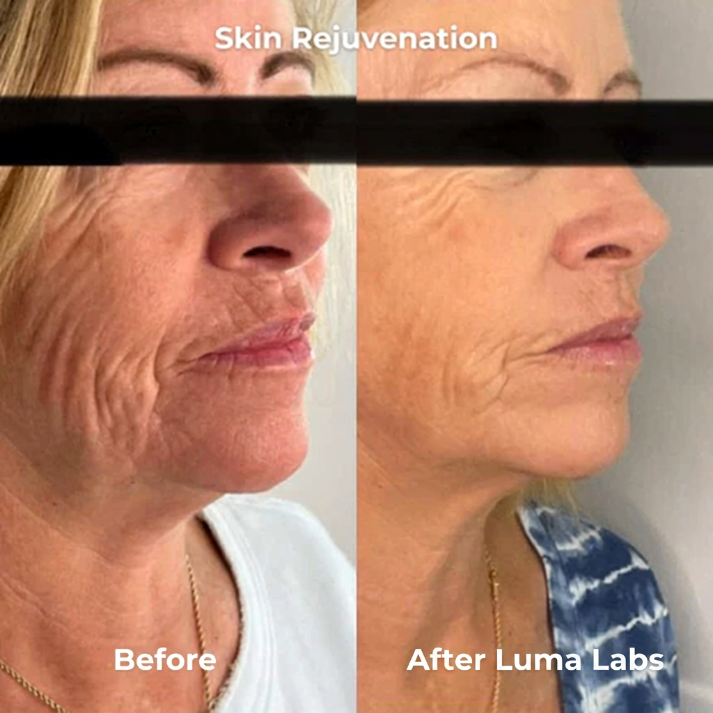 Luma Labs - The Formula‎