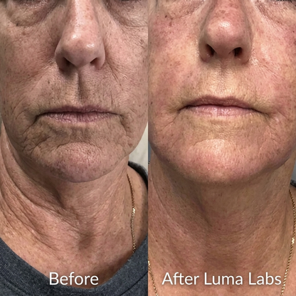 Luma Labs - The Formula‎