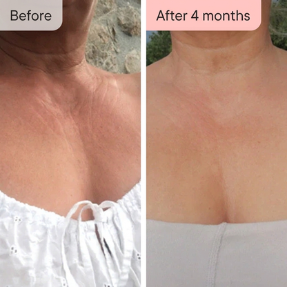 Luma Labs - Neck + Décolletage Restore