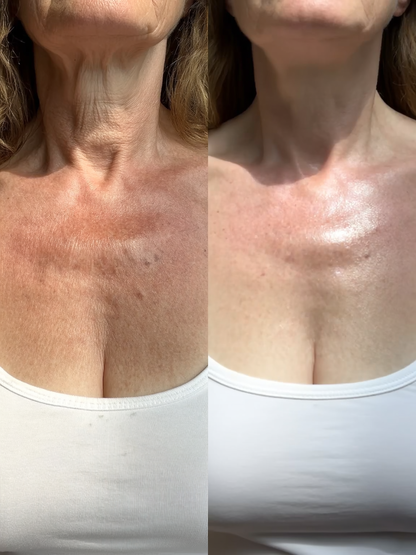 Luma Labs Décolletage Restore