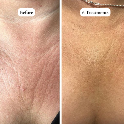 Luma Labs Décolletage Restore