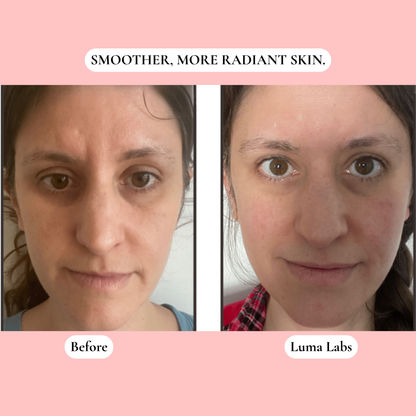 The Luma Labs Formula