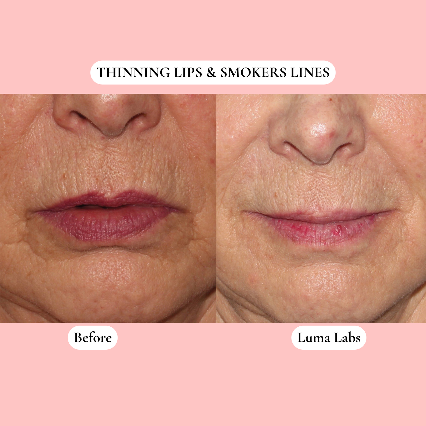 The Luma Labs Formula