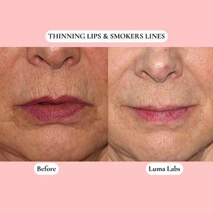 The Luma Labs Formula