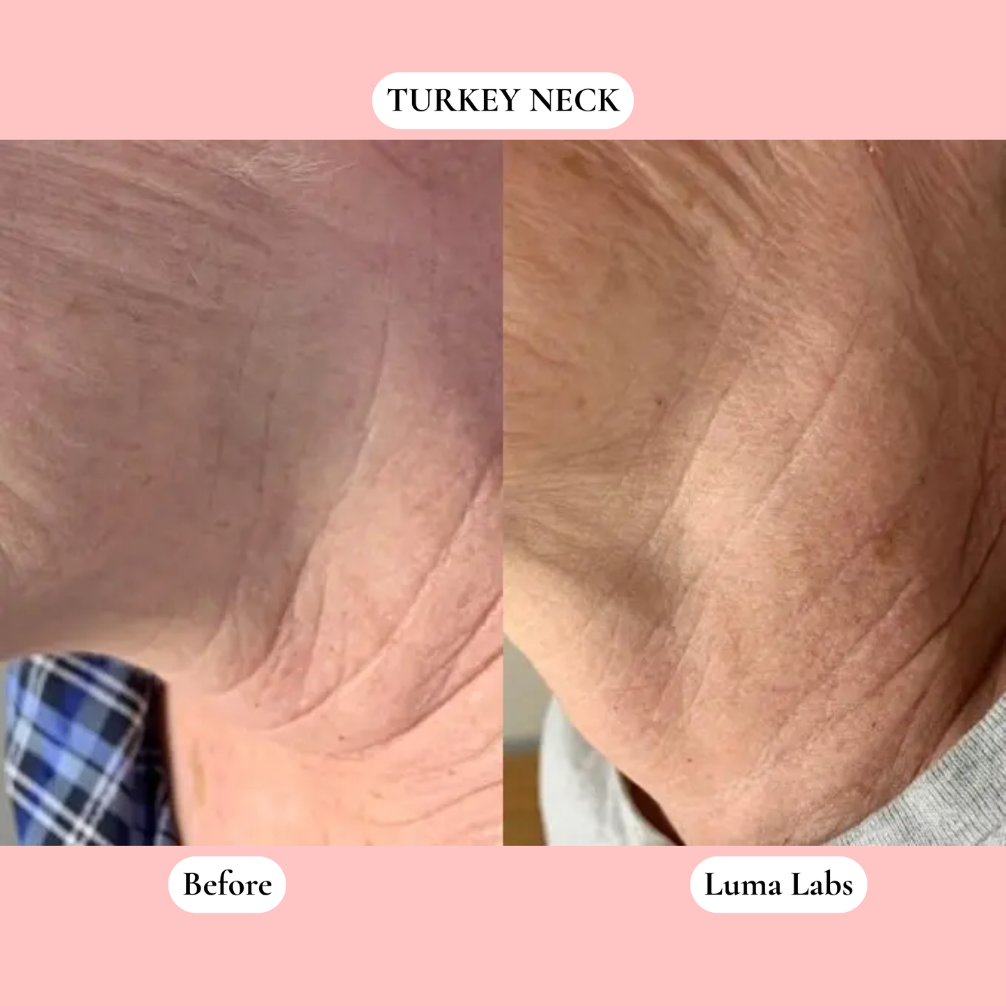 The Luma Labs Formula