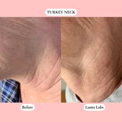 The Luma Labs Formula